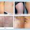 Skin Renewing Co2 Fractional Laser Vaginal Tightening Face Whitening Dermatology Beauty Machine Wrinkle Removal Acne Scar Removal