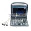 2015 hot selling Veterinary Instrument Ultrasound Scanner ECO1 VET with 2.5-11MHz probe frequency