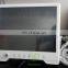 MY-A012 Portable ultrasound & ultrasound machine portable & ultrasound diagnostic equipment