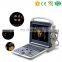 China cheapest medical Full Digital Color Doppler B Ultrasound Machine/Scanner for pregnancy with ultrasonic probe