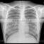 digital film medical, thermal x-ray film, film xray