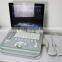 3D 4D Portable Color Doppler Ultrasound Machine C5