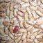 We are supply light speckelkidney beans with best price for sale