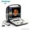 Cheap best selling color doppler portable echo machine