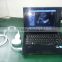 USB Probe ultrasound scanner can connect the tablet and laptop