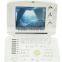 Good price 10 inch digital Ultrasound machine with Convex probe for hospital clinic community with CE certification