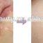 690-1200nm 0.1-2.6mm Vagina Tightening Fractional Co2 Laser Scar Removal Acne Removal Laser Cutting Beauty Salon Equipment Remove Neoplasms Armpit / Back Hair Removal