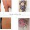 Haemangioma Treatment Effective Laser Tattoo Pigmentation Removal/all Q Switch Laser Tattoo Removal Color Tattoo Removal Machine/beauty Salon Tattoo Removal Machine Tattoo Removal System