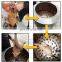centrifugal poultry hair removal machine / plucking machine / bird/quail/chicken/duck/goose feather plucker
