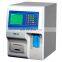 TEK-2A easy operate MINI blood cell analyzer