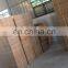 Best selling economical stainless steel ward screen for hospital 201 stainless steel