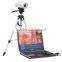 Digital Laptop Colposcope for Gynaecological/vaginal & uterine diagnosis/surgery