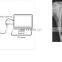MY-D019D hospital medical device radiology equipment portable x ray machine price