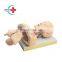 HC-S032 Advanced Airway Management Model,Tracheal Intubation Training Model Mannequinwith Alarm