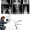 MY-D019I medical hospital instrument radiology dr system rayos x portatil mobile xray digital machines 100ma portable x ray