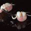 Removable Denture  Dental laboratory in china