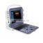 Portable 3D 4D Convex Scanner Color Doppler Ultrasound Machine for hospital