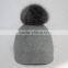 Myfur Adult Unisex Fedora Hat with Detachable Genuine Fox Fur Bobble