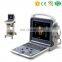 MY-A035A medical portable or trolley type full digital color doppler ultrasound scan/scanner/machine price with ultrasonic probe
