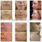 microneedle therapy system rf Skin tighten microneedling fractional radio frequency machine / rf micro needleing machine