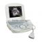 CE& FDA approved Digital Portable Ultrasound Scanner Suitable for the diagnosis of Abdomen, Cardiac, Gynecology, Obstetrics