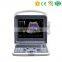 Newest MY-A025 Portable 4D Cardiac color doppler ultrasound scanner