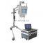 MY-D019D hospital medical device radiology equipment portable x ray machine price
