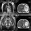 Factory Direct MY-D054 Medical 0.35T MRI Scan System C-shape Permanent Magnetic Resonance Imaging MRI Machine For Hospital Use
