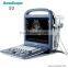 Animal Color Doppler Utrasound sonoscape veterinary