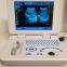 Notebook Type Black and White Ultrasound Scanner Medical Equipment