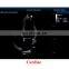 Original Mindray mindray DP-7 trolley Full digital ultrasound equipment machine with stock