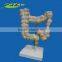 human Disease Large Intestines Model
