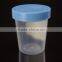 120ML Medical Plastic Urine Cup,urine Sample Cup Urine Container
