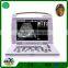 Laptop vet ultrasound scanner devices for various animal test use 3018vp