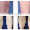 Potable IPL Hair Removal Home Use Hair Removal Mini IPL for Beauty Salon System
