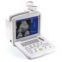 Portable Convex Ultrasound Scanner---CE certified