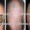 2000mj q switch nd yag laser tattoo removal machine for birthmark/keyword:nd yag laser