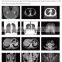 MY-D055J hospital instrument spiral computed tomography machine medical 16 slice ct scan machine