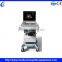 Ultrasound Machines 3d 4d