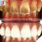 independent distributor opportunities teeth whitening set