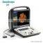 4D Sonoscape S6 Portable ultrasound machine color doppler