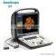 S6 SonoScape medical 3d echo machine color doppler