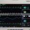 12 INCH Multi-parameter Patient Monitor ETCO2 thermal recorder Optional RPM 9000A