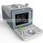 MY-A001A Laptop full digital portable ultrasound scanner mini ultrasound machine