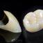 IPS e.max  Zirconia Crown manufacturers China Dental Lab