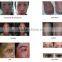Newest Medical Q Switch Nd yag Laser Tattoo Removal Equipment/machine
