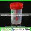 Colorful Sterile Specimen Container,disposable 60ml Stool Container Specimen Container