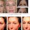 hot sale best effect wrinkle removal ,skin rejuvenation,whitening face lift salon use hifu beauty