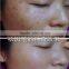 2016 New Freckle Spot Mole Removel laser pen beauty skin laser pen