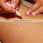best Aesthetic Laser Diode Module for hair removal/epilation